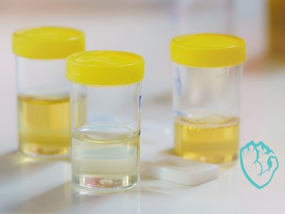 How-Long-is-MK-677-Detectable-in-Urine